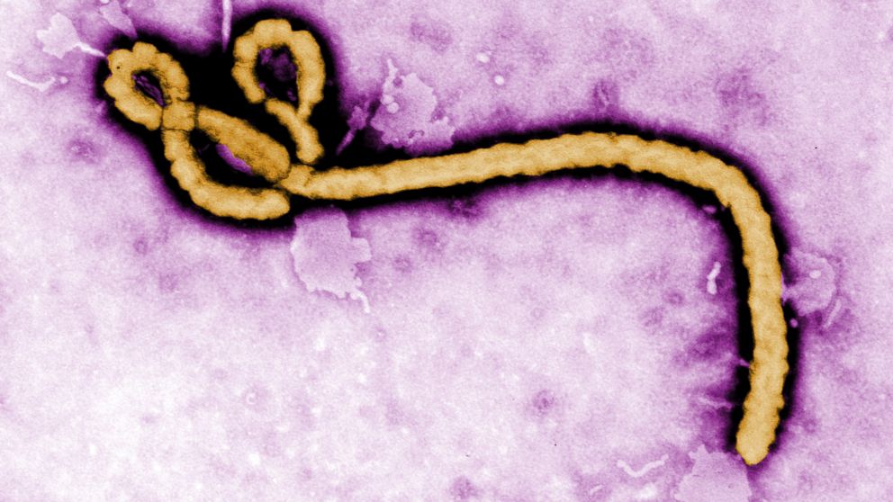 Ebola virus